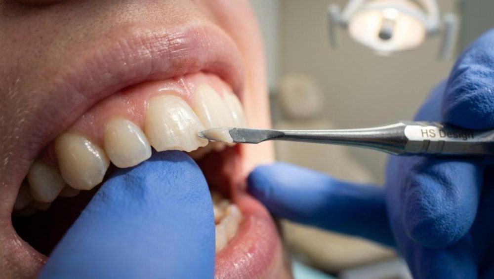 cosmetic dentistry