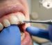 cosmetic dentistry